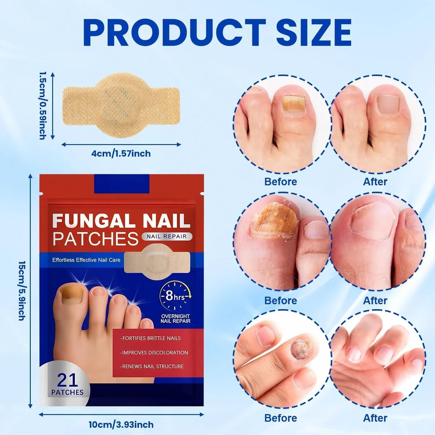 Fungal Nail Repair Patches