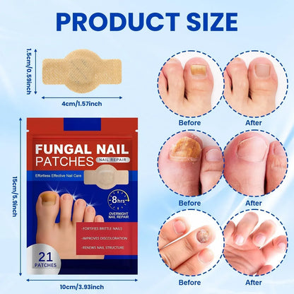 Fungal Nail Repair Patches