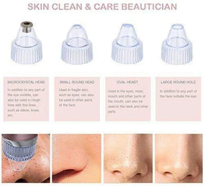 Pore Cleaning Device - easy blackheads cleaner