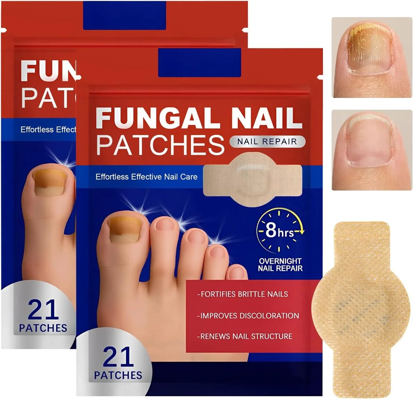 Fungal Nail Repair Patches