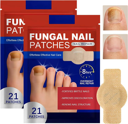Fungal Nail Repair Patches